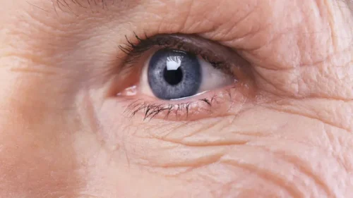 أفضل الطرق الطبيعية لتفادي تجاعيد الوجه المبكرة